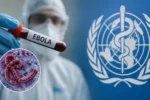 ebola